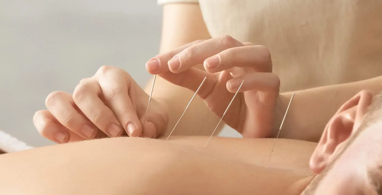 Meridian Conditioning Acupuncture