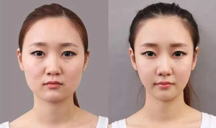 freehand plastic surgery